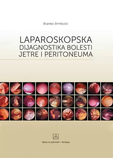 laparoskopska dijagnostika bolesti jetre i peritoneuma branko brmbolić
