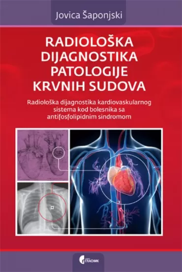 radiološka dijagnostika patologije krvnih sudova jovica šaponjski