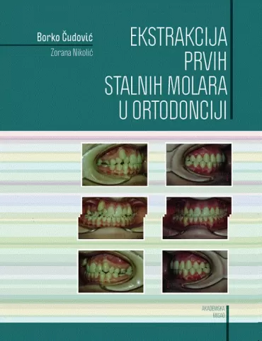 ekstrakcija prvih stalnih molara u ortodonciji borko čudović